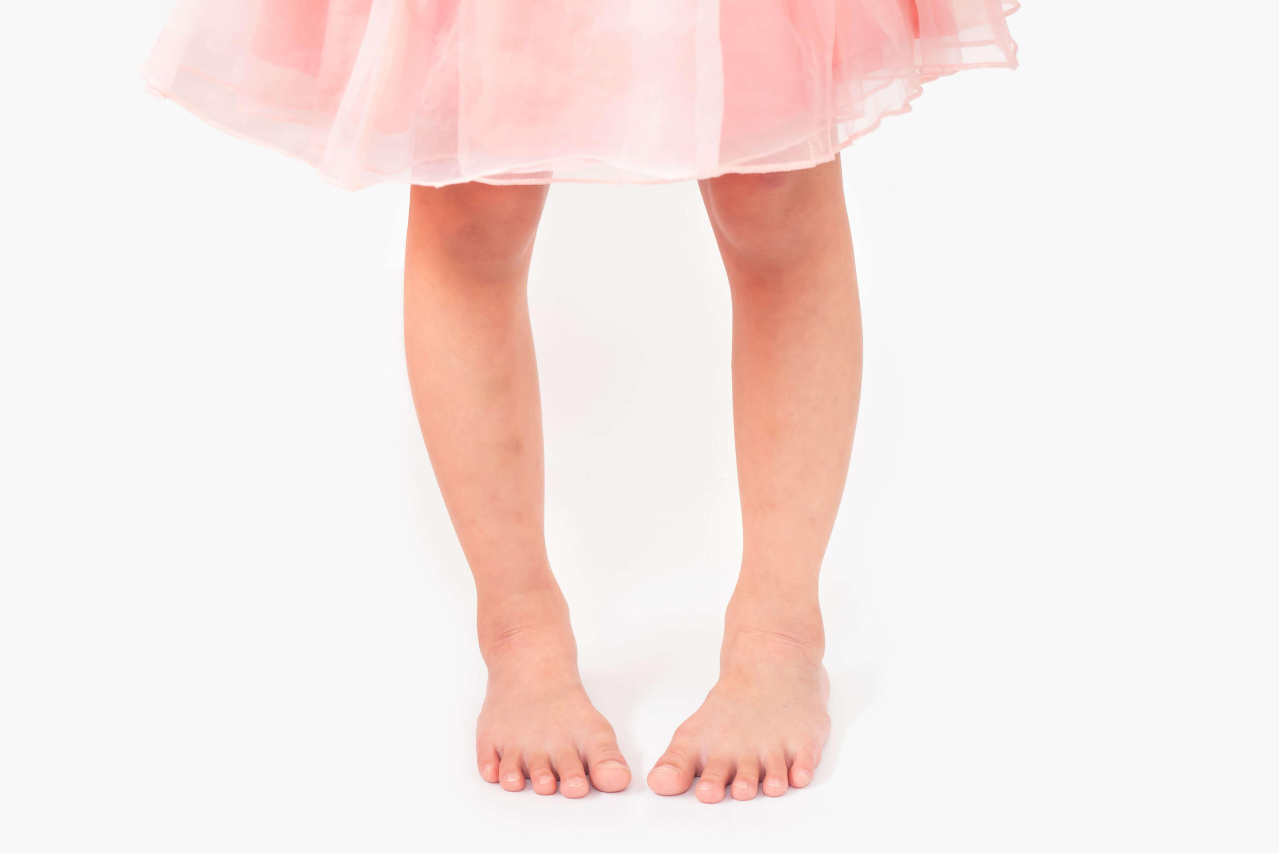 Genu Varum Ameliyatı